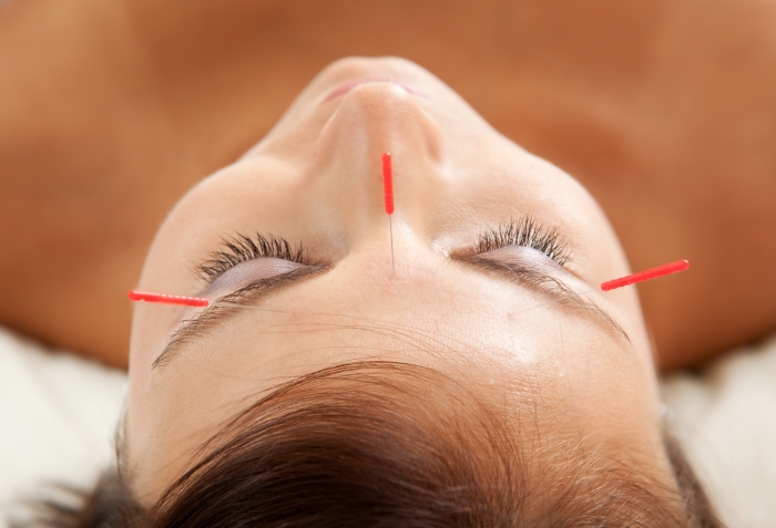 facial acupuncture