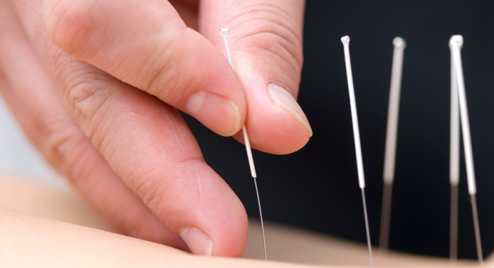 Welcome to The Acupuncture Turning Point