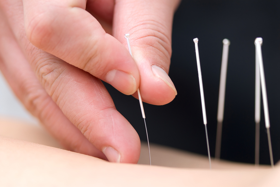 Welcome to The Acupuncture Turning Point