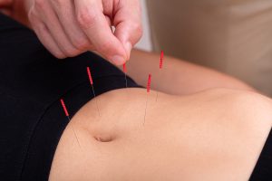 acupuncture for digestion