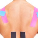 Kinesiotaping after acupuncture