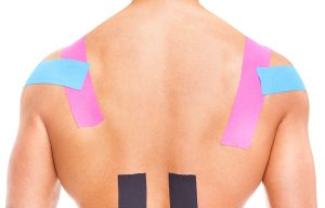 Kinesiotaping after acupuncture